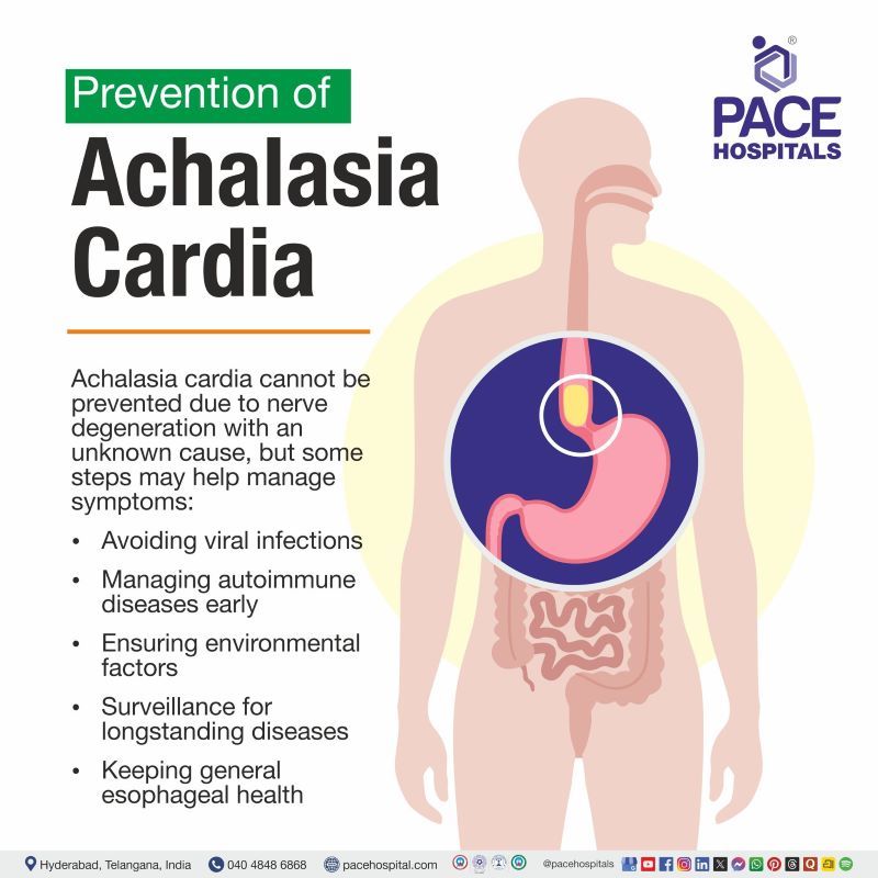 Achalasia Cardia Prevention Achalasia Cardia Prevention | Prevention of Achalasia Cardia