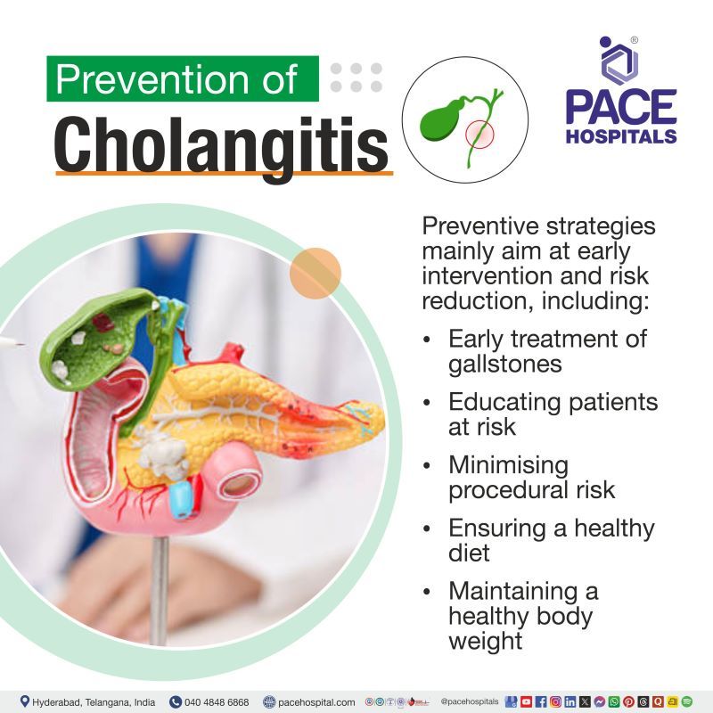 Cholangitis Prevention | Prevention of Cholangitis
