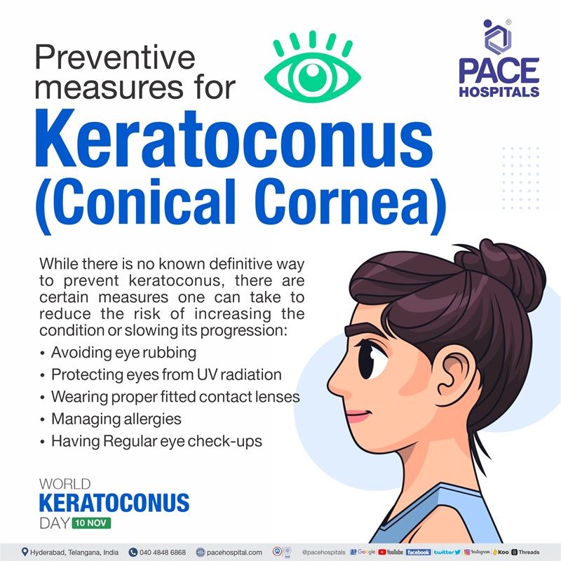 Preventive measures for Keratoconus - conical cornea | World Keratoconus Day