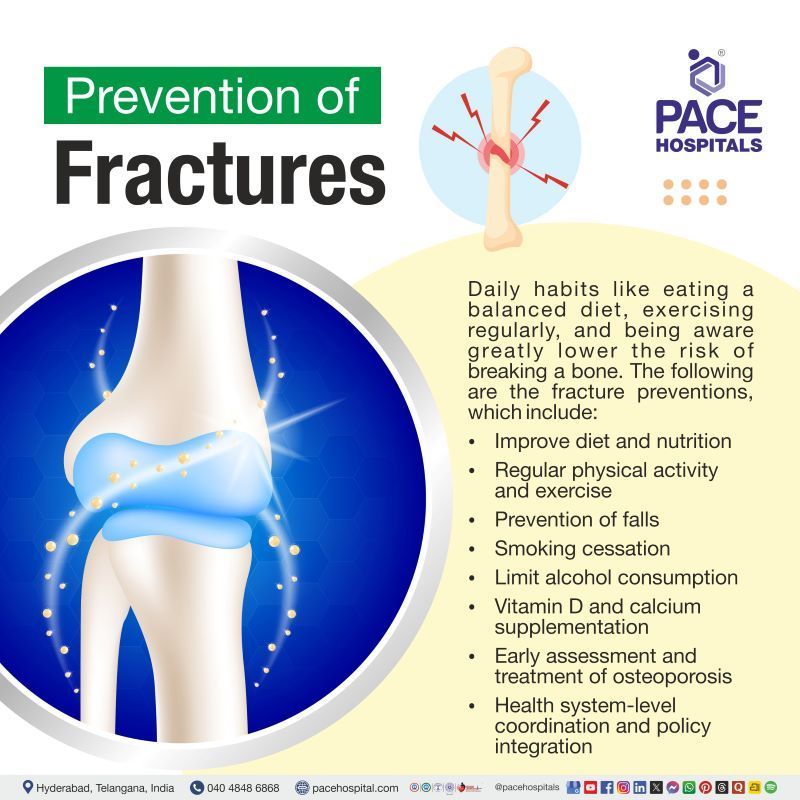 Prevention of Fracture Prevention of Fracture | Fractures Prevention