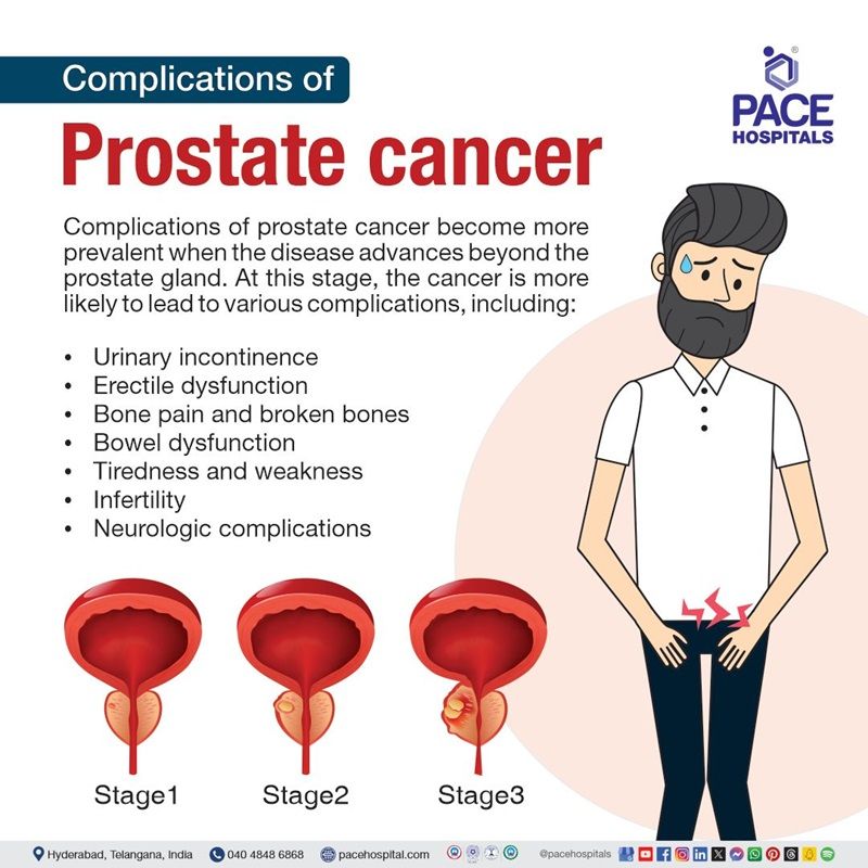 complications of prostate cancer | prostate cancer complications​ | what are complications of prostate cancer​ | Visual depicting the complications of Prostate cancer