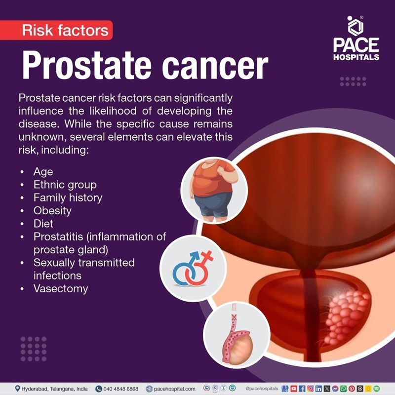 prostate cancer risk factors​ | risk factors for prostate cancer​ | risk factors of prostate cancer​ | prostate cancer causes and risk factors​
