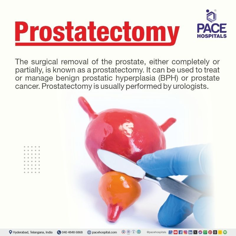 laparoscopic prostatectomy in Hyderabad | robotic prostatectomy in Hyderabad | prostatectomy surgery cost in Hyderabad | radical prostatectomy in India | open prostatectomy in Telangana | Visual depicting the meaning of  prostatectomy procedure