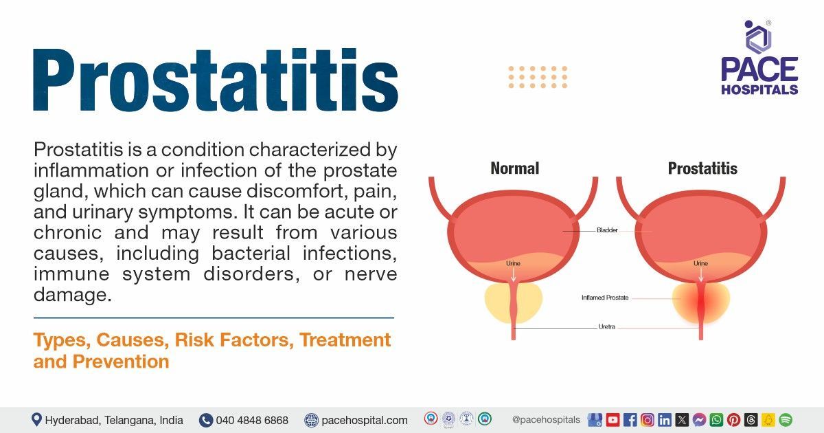 What is Prostatitis  | Prostatitis symptoms and causes | Prostatitis treatment in India