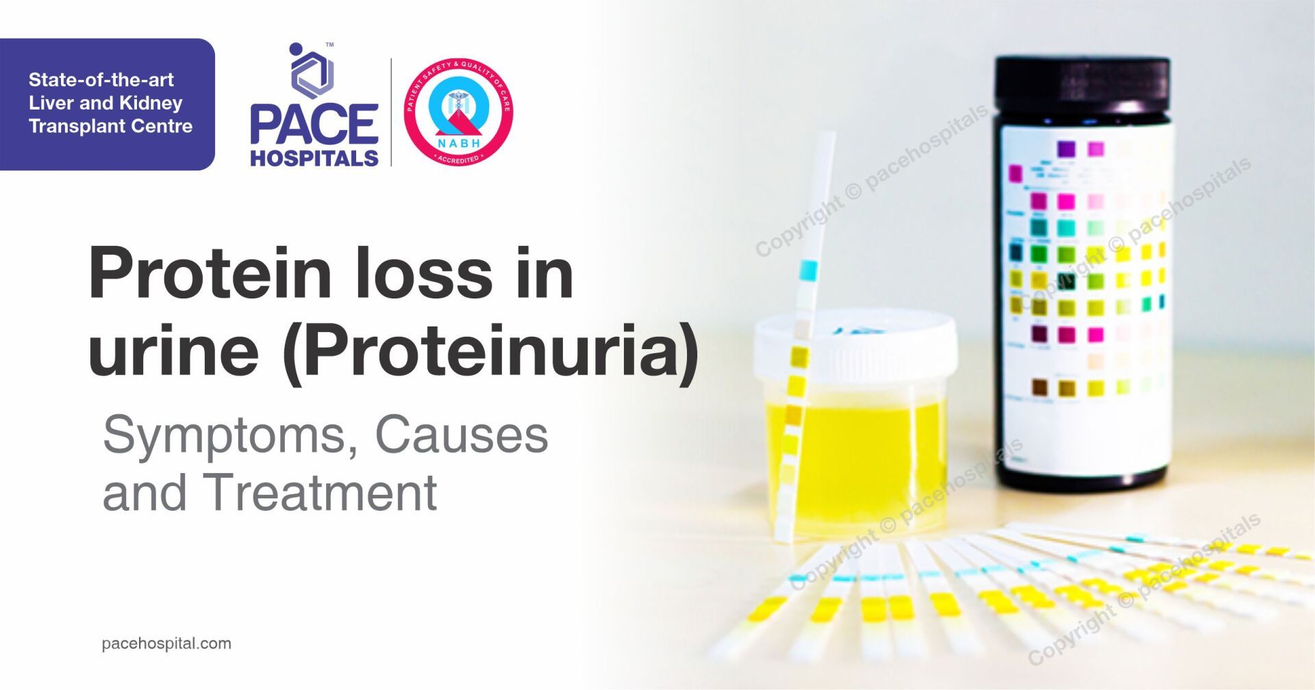 Protein loss in urine (Proteinuria) - Symptoms, Causes and Treatment