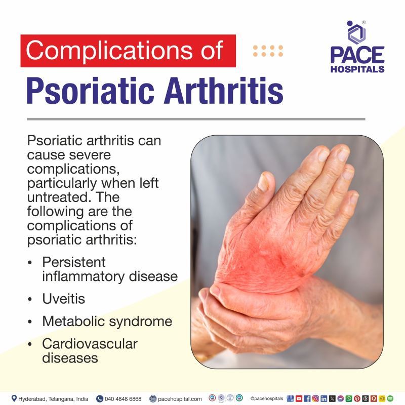 Psoriatic Arthritis Complications Psoriatic Arthritis Complications | Complications of Psoriatic Arthritis | Complication of PsA