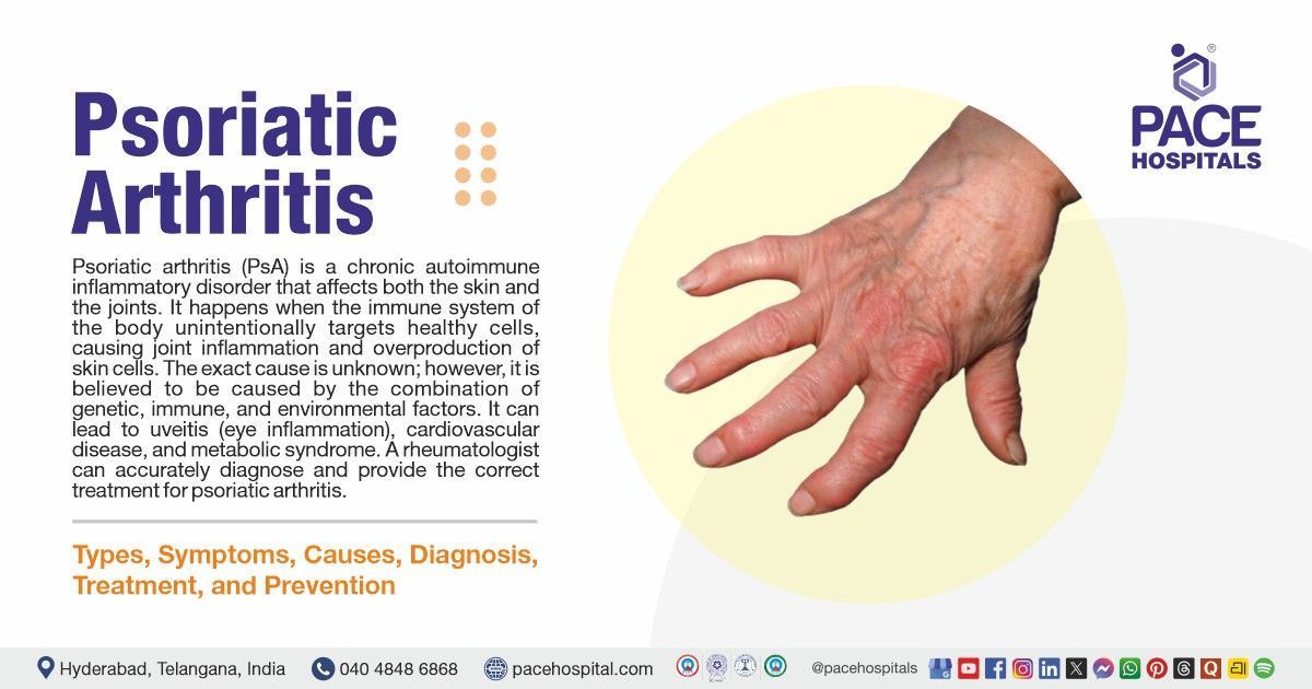 Psoriatic Arthritis - Symptoms, Causes, Treatment & Prevention | what is psoriatic arthritis