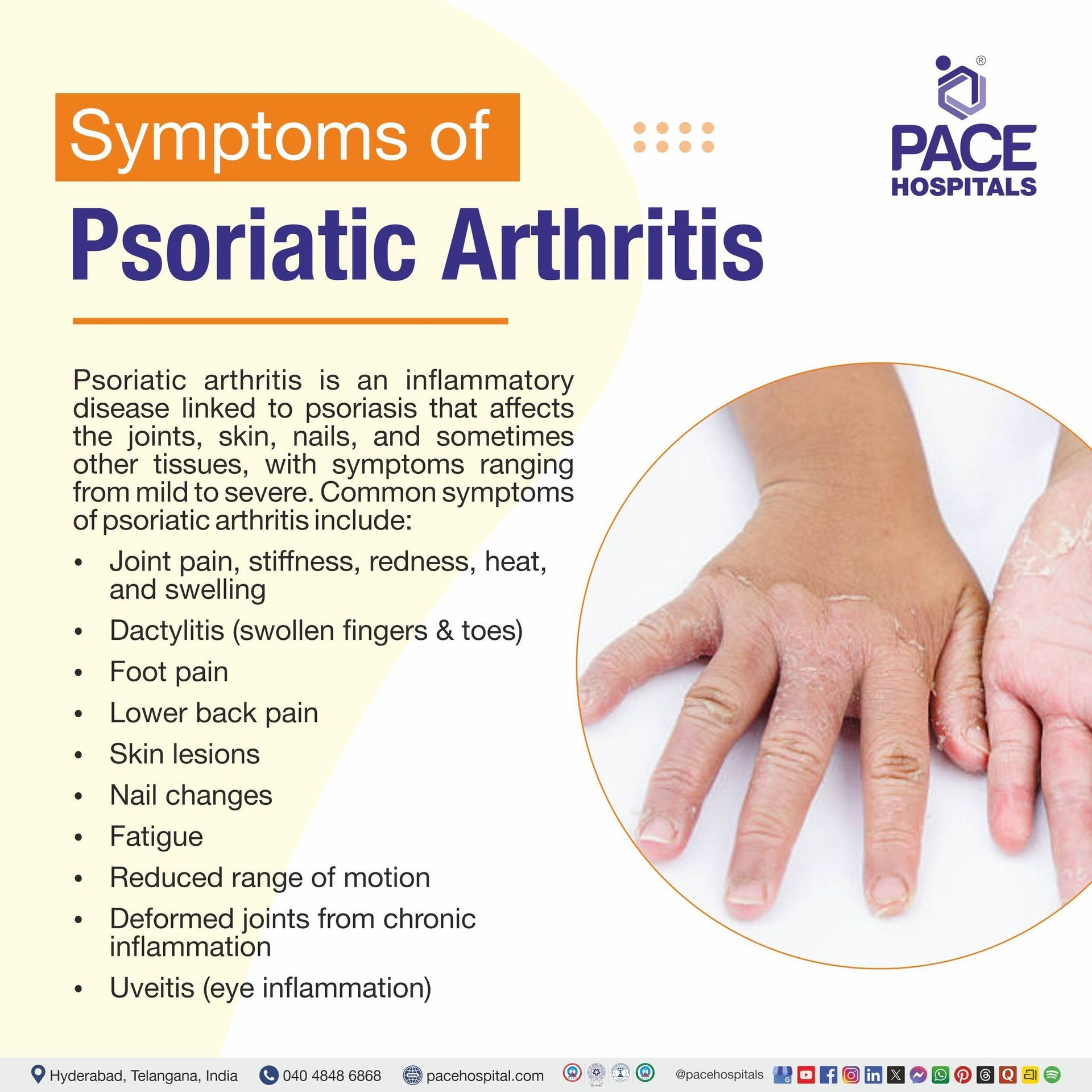 Psoriatic Arthritis Symptoms Psoriatic arthritis symptoms | Psoriatic arthritis early symptoms | PsA symptoms
