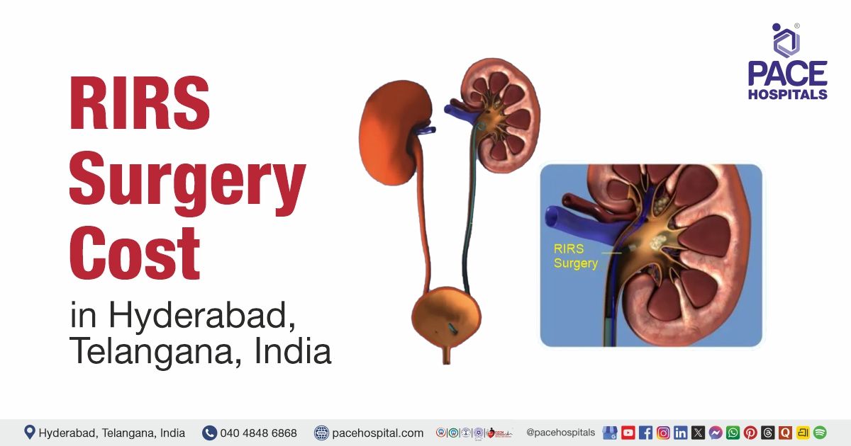Cost of RIRS surgery at PACE Hospitals in Hyderabad, India. RIRS surgery Cost estimate