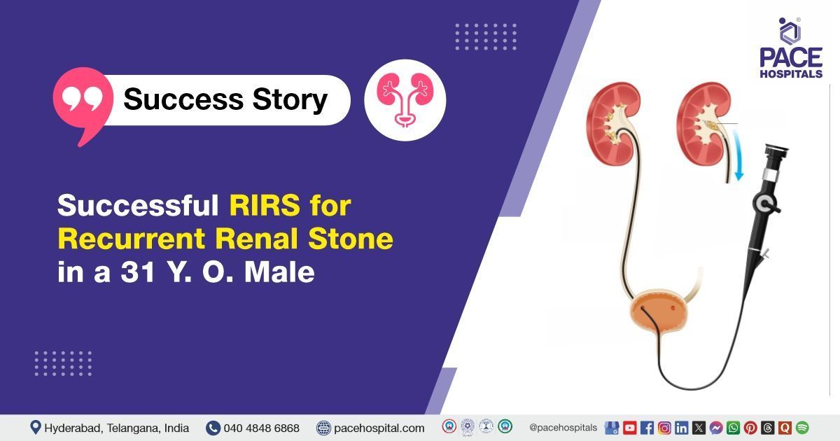 Case study of a 31-Y-O patient suffering from Kidney stones treated with RIRS at PACE Hospitals, Hyd