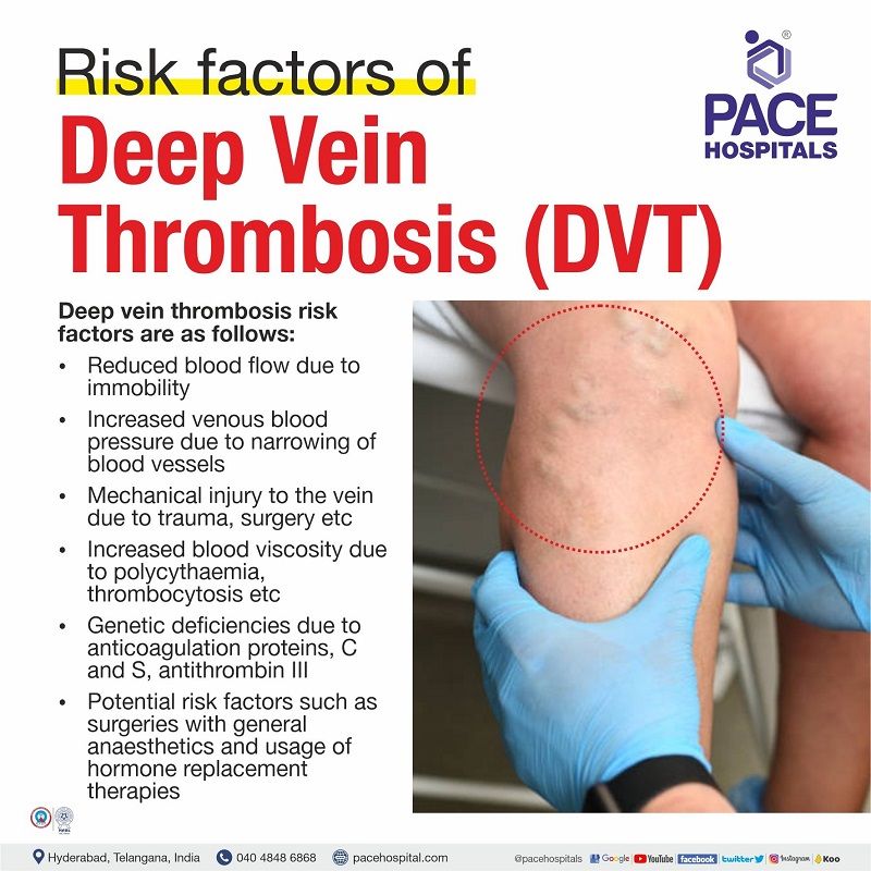 Deep Vein Thrombosis, DVT - Symptoms, Causes And Complications