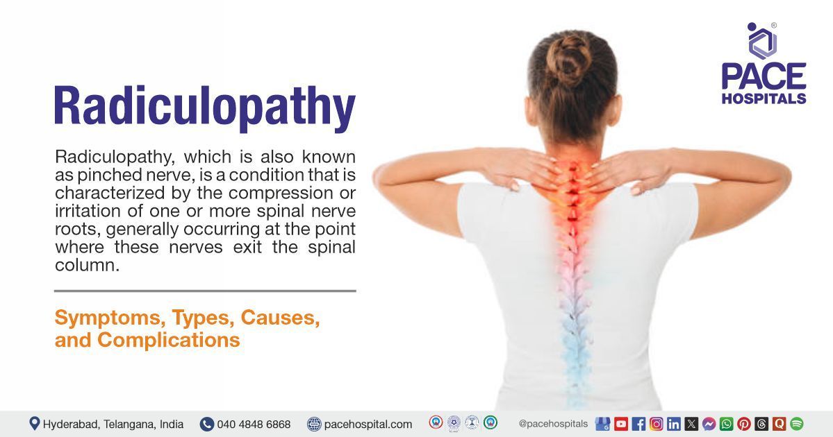 What is radiculopathy​ | Radiculopathy treatment in India | cervical radiculopathy | radiculopathy l