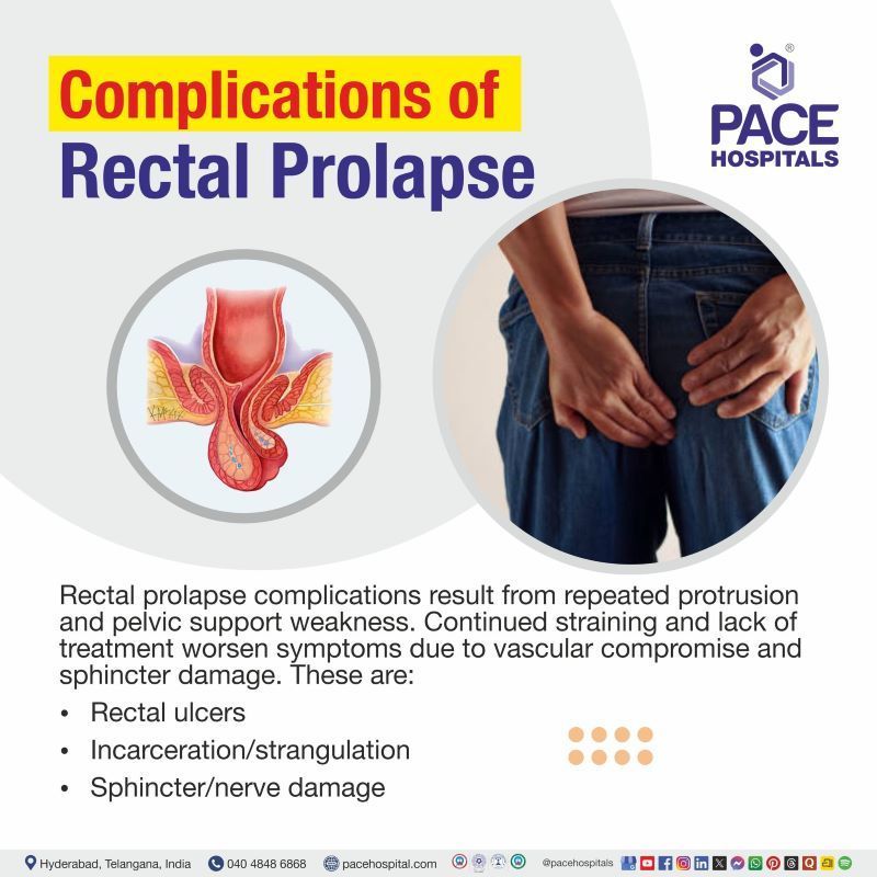 Rectal Prolapse Complications Rectal Prolapse Complications | Complications of Rectal Prolapse