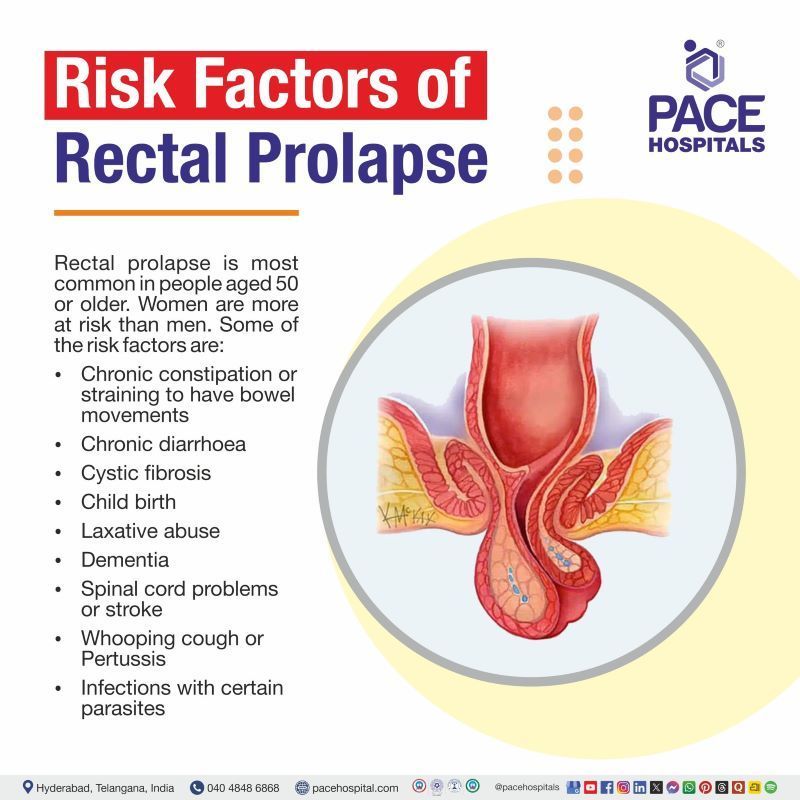 Rectal Prolapse Risk Factors Rectal Prolapse Risk Factors | Risk factors of Rectal Prolapse