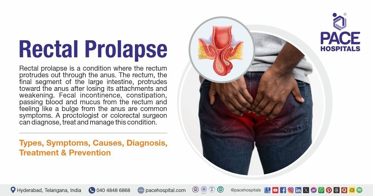 Rectal Prolapse - Symptoms, Causes, Diagnosis, Treatment & Prevention | What is Rectal Prolapse