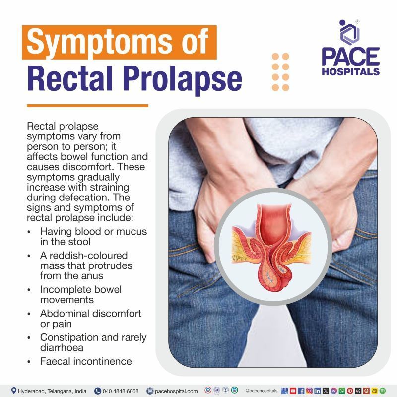 Rectal Prolapse Symptoms Rectal Prolapse Symptoms | rectal prolapse pictures symptoms | rectal prolapse symptoms signs | signs and symptoms of rectal prolapse