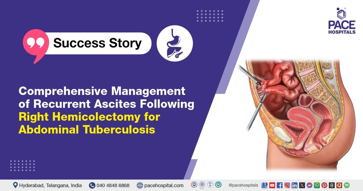 Case study of a 20-year-old female with recurrent ascites treated at PACE Hospitals, Hyderabad