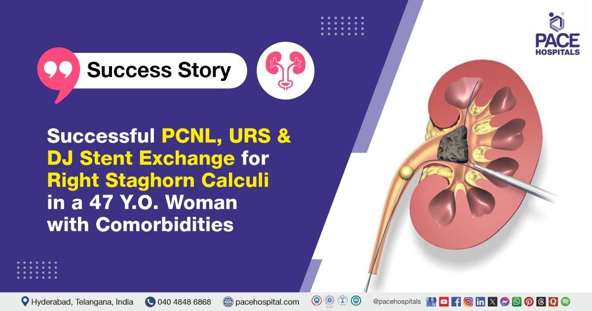 Case study of a patient with kidney stones successfully treated at PACE Hospitals, Hyderabad