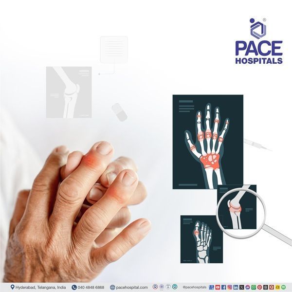 Advanced Rheumatology Tests at PACE Hospitals, Hyderabad Expert care with best Rheumatology Doctors at PACE Hospitals, Hyderabad