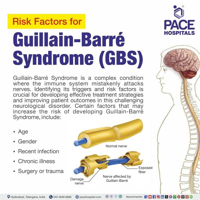 Risk factors of Guillain-Barré syndrome Risk factors of Guillain-Barré syndrome | Visual depicting the Risk factors of Guillain-Barré syndrome