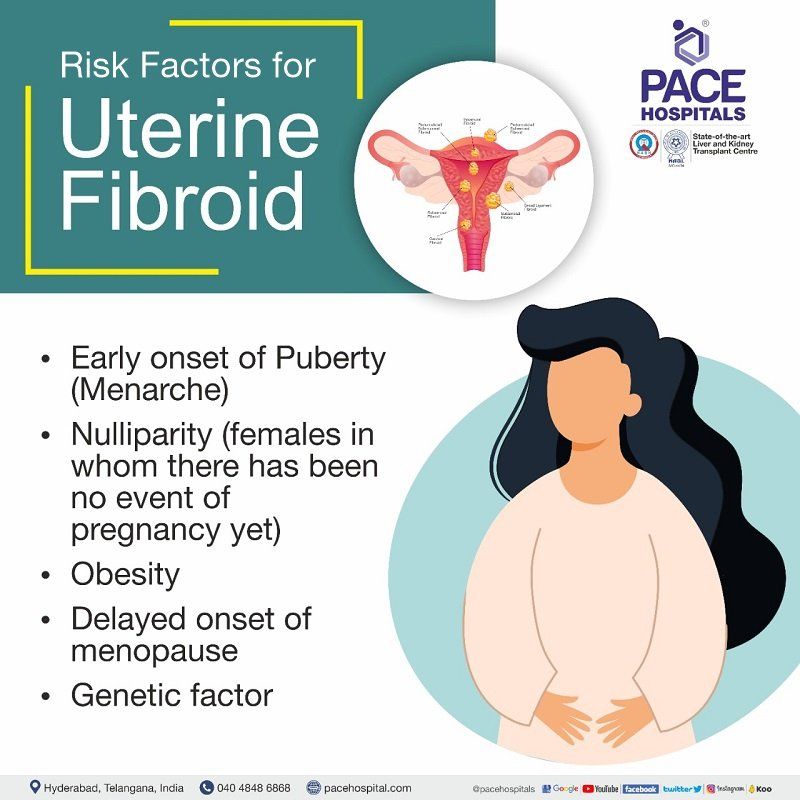 Risk Factors for Uterine Fibroids