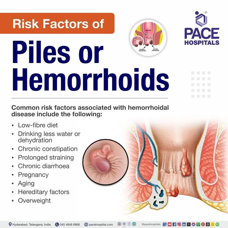 Piles risk factors risk of piles | piles risk factors | risk factors of Hemorrhoids | Hemorrhoids risk factors | Visual reveling the risk factors of Piles(Hemorrhoids)