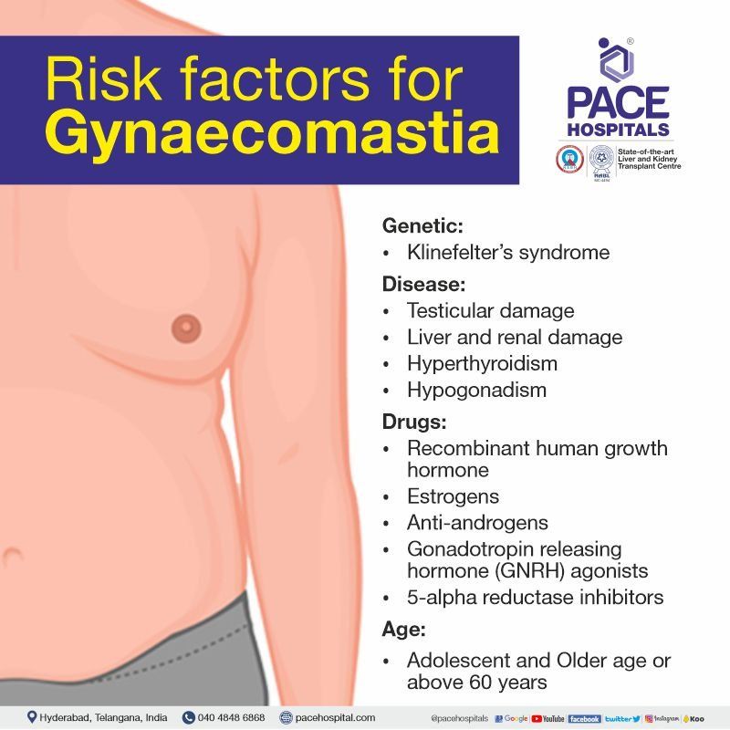 gynecomastia risk factors | gynaecomastia