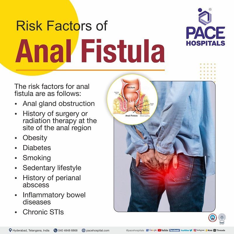 risk factors for anal fistula | risks of fistula in ano | anal fistula risks | fistula in ano risk factors
