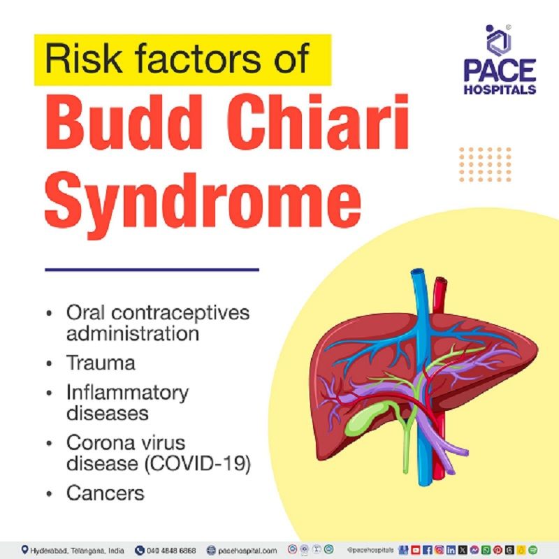 Risk factors of Budd-Chiari Syndrome | Budd-chiari syndrome risk factors | what are the risk factors of Budd-Chiari syndrome | Visual explaining the risk factors of Budd-Chiari syndrome