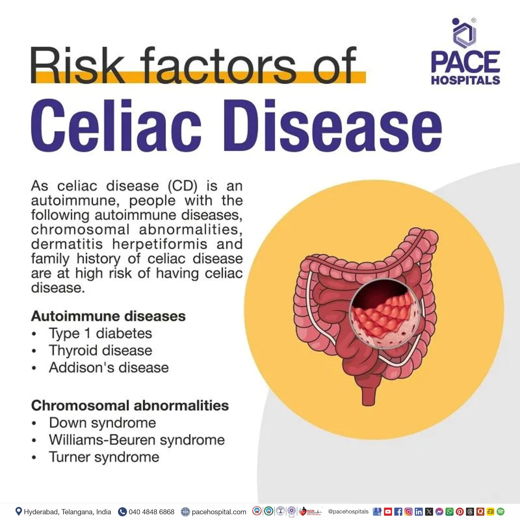 Risk Factors of Celiac Disease Celiac Disease Risk Factors