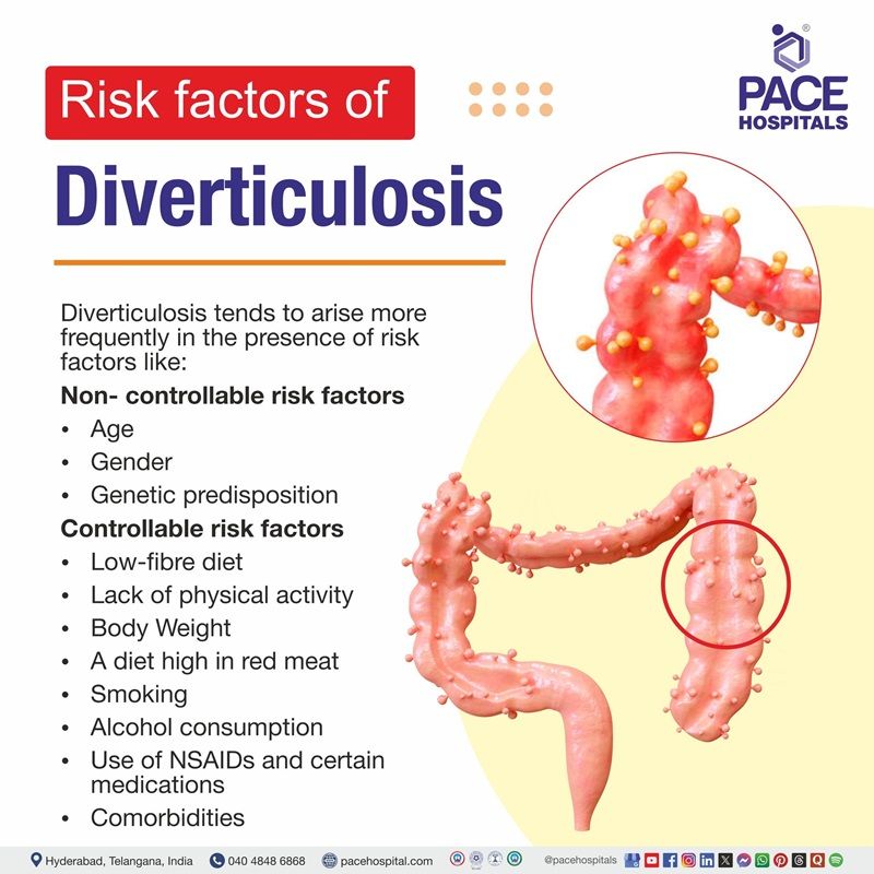 Diverticulosis Risk Factors Diverticulosis Risk Factors | Risk Factors of Diverticulosis