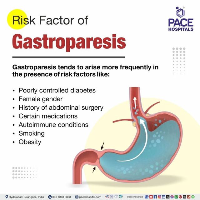 gastroparesis caused by glp 1 Gastroparesis: Symptoms, Causes, Diagnosis, Treatment, Prevention