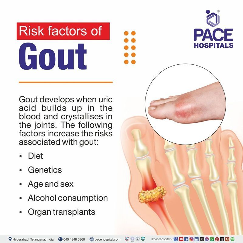 Risk Factors of Gout | Gastroparesis Gout