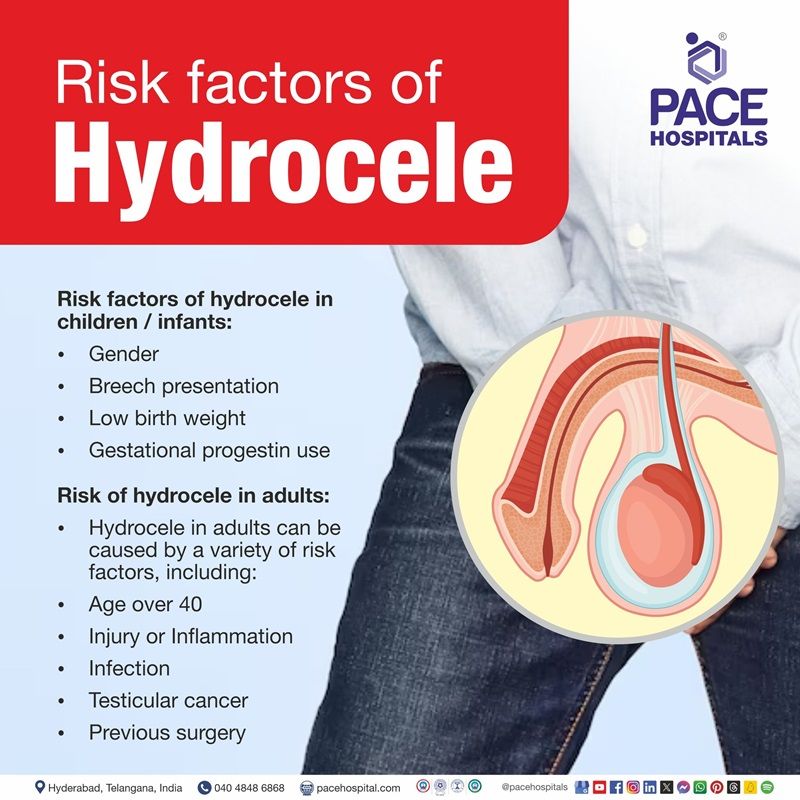 hydrocele risk factors | risk factor of hydrocele | hydrocele causes risk factors​ | what are the risk factors of Hydrocele 