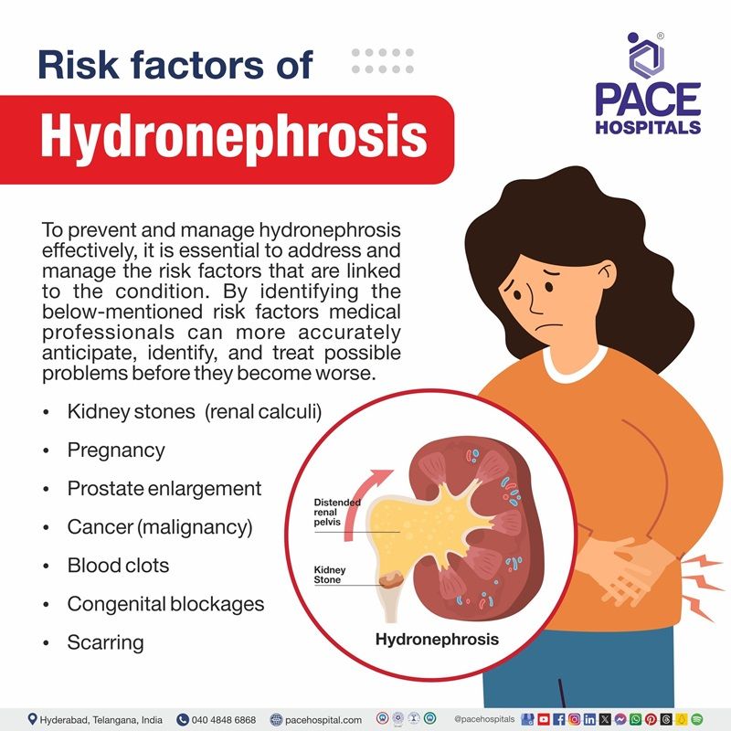 Kidney hydronephrosis risk factors | risk factors of hydronephrosis