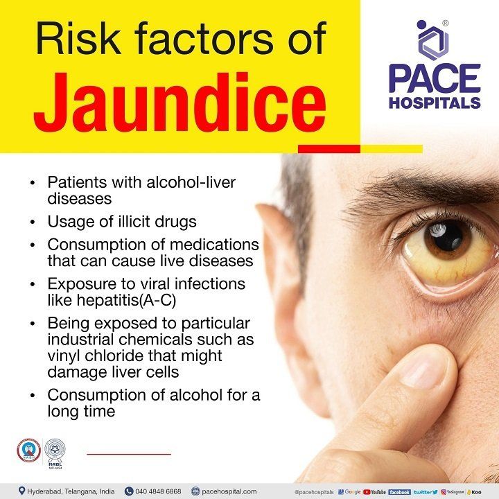 jaundice risk factors | risks of jaundice