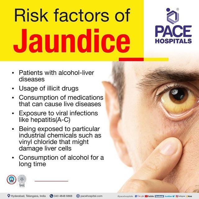 Jaundice In Adults