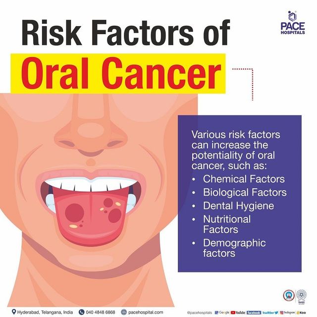 Causes of Oral Cancer