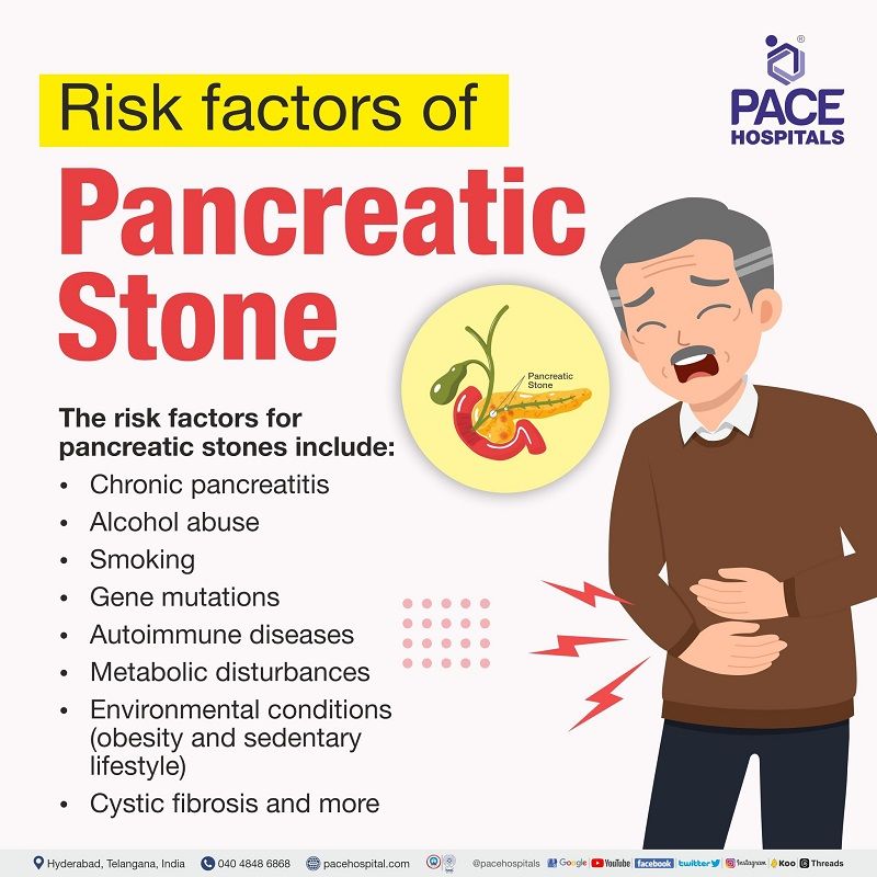 risk factors of pancreas stones | pancreatic stones risk factors | pancreatolithiasis risk factors | pancreatic calculi symptoms