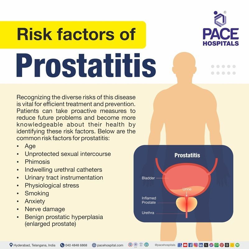  Risk factors of Prostatitis | Prostatitis risk factors | what are the risk factors of Prostatitis | Visual revealing the risk factors of Prostatitis 