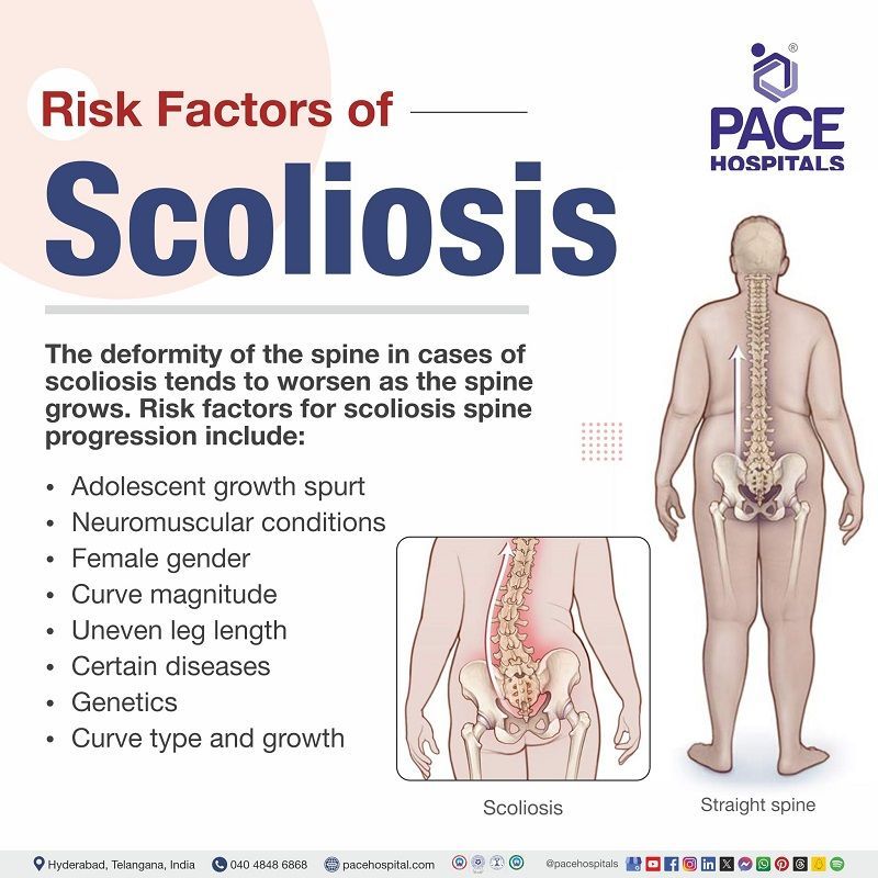 scoliosis risk factors | scoliosis risks | risk factors of scoliosis | Visual unfolding the risk factors of scoliosis 
