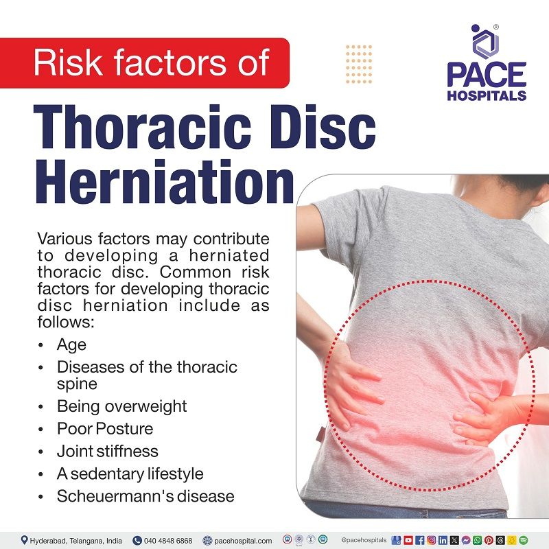 Thoracic herniated disc risk factors Thoracic herniated disc risk factors | risk factors of Thoracic herniated disc | Visual depicting the risk factors of Thoracic herniated disc