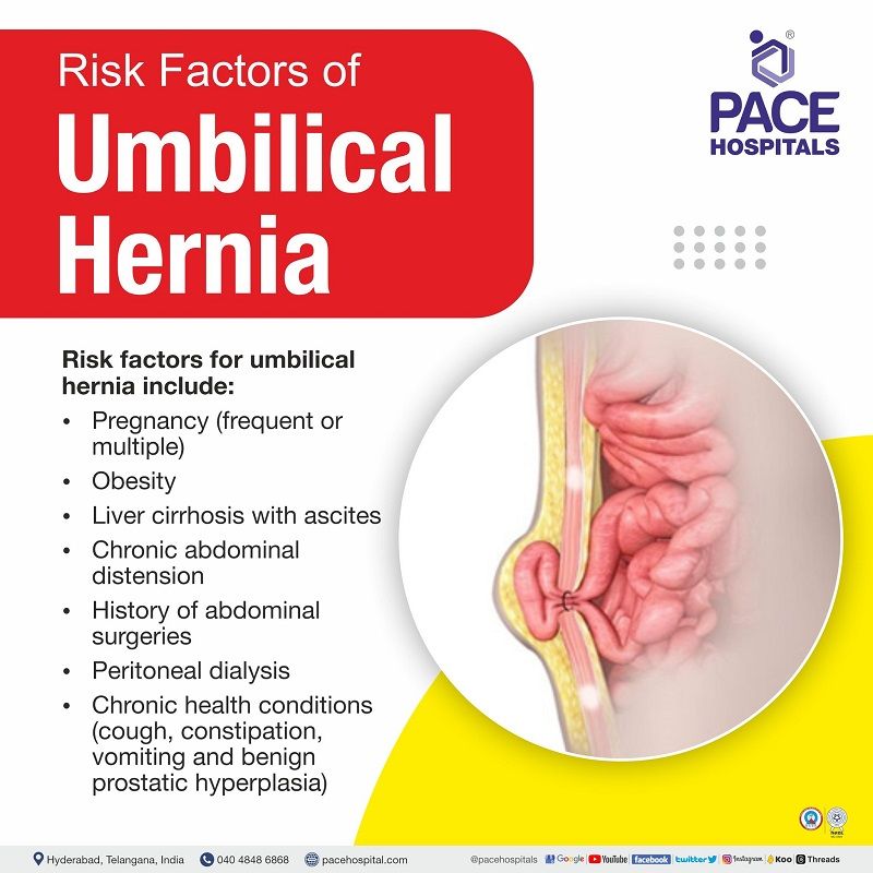 risk factors of umbilical hernia, India | paraumbilical hernia risk factors | umbilical hernia risk of strangulation | umbilical hernia risk factors | belly button hernia risk factors