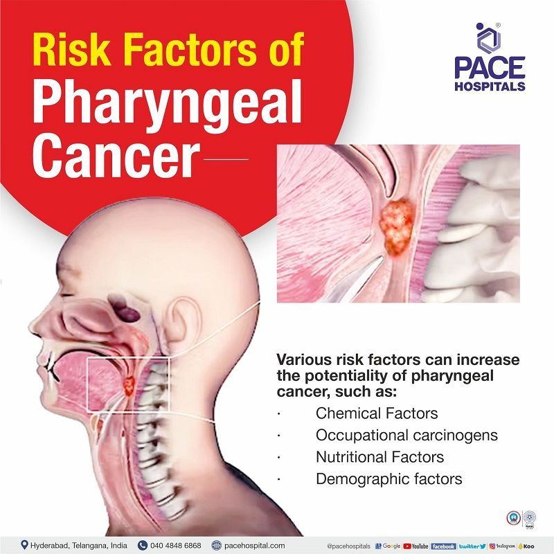 pharyngeal cancer risk factors | risk factors for pharyngeal cancer | pharyngitis cancer risk factors