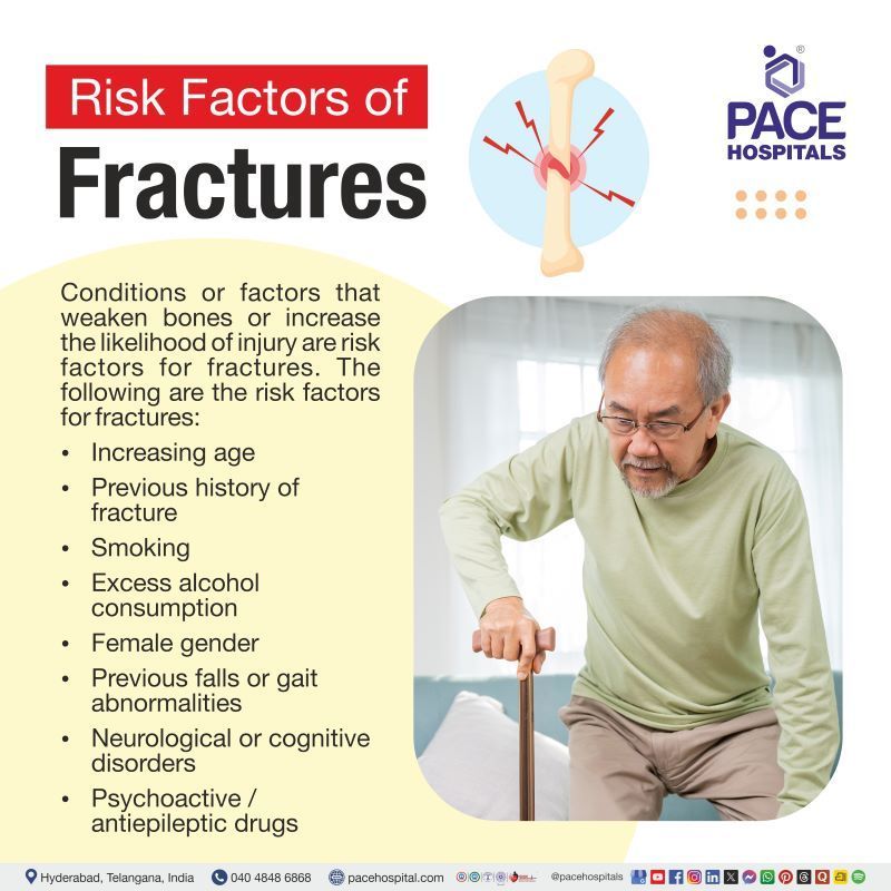 Risk Factors for Fractures Risk Factors for Fractures | Fractures risk factors