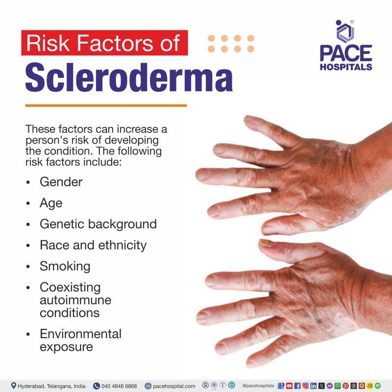 Risk Factors of Scleroderma Risk Factors of Scleroderma | Scleroderma Risk Factors