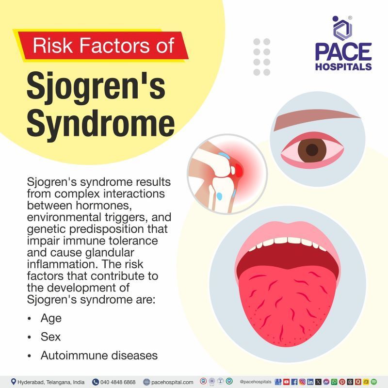 Risk Factors of Sjogren's Syndrome Risk Factors of Sjogren's Syndrome | risk factors for sjogren's syndrome | sjogren's syndrome risk factors