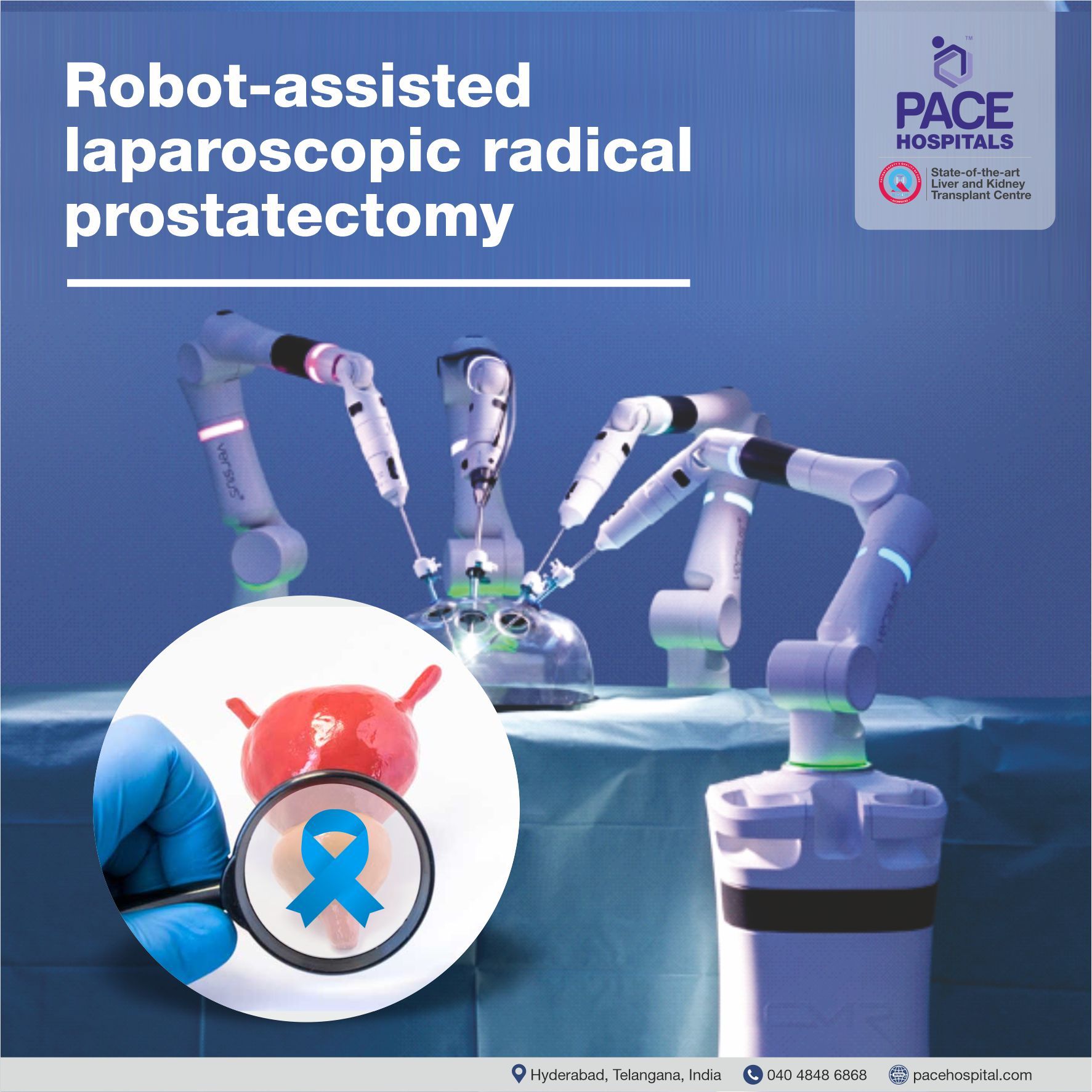 Robot-assisted laparoscopic radical prostatectomy