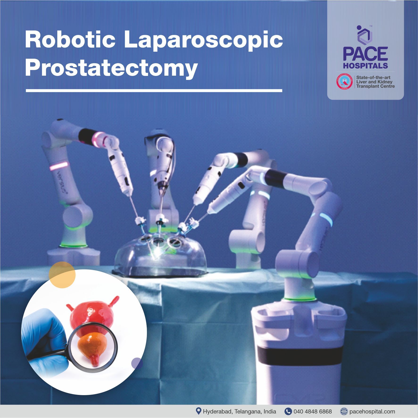 Robotic Laparoscopic Prostatectomy Surgery - Robotic Prostate Surgery in Hyderabad