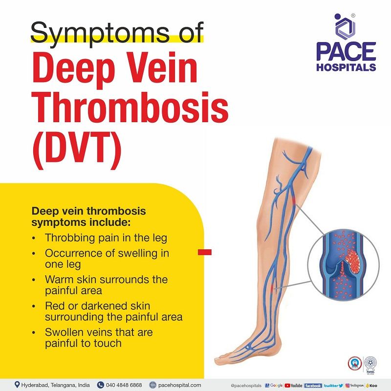 dvt symptoms | deep vein thrombosis symptoms | early stage dvt signs and symptoms leg | dvt and pe symptoms | deep vein thrombosis signs and symptoms